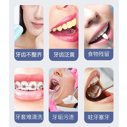 博皓便攜式智能洗牙器 開啟高效、便捷的口腔清潔新體驗